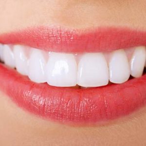 What are the top dental cosmetic treatments in 2019